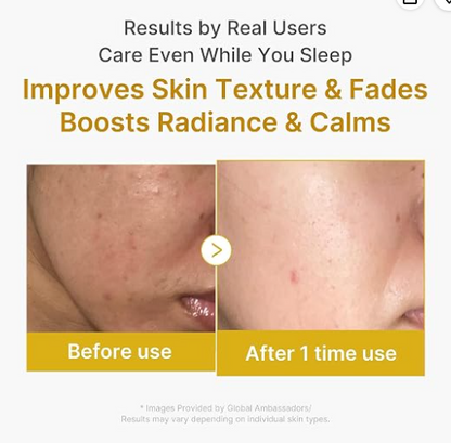 Medicube Masque Wrapping à l’Acide kojique Curcuma Peel Off Nuit