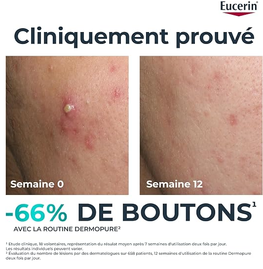 Pack peau grasse, anti-boutons & imperfections- باقة البشرة الدهنية – لمكافحة الحبوب والعيوب
