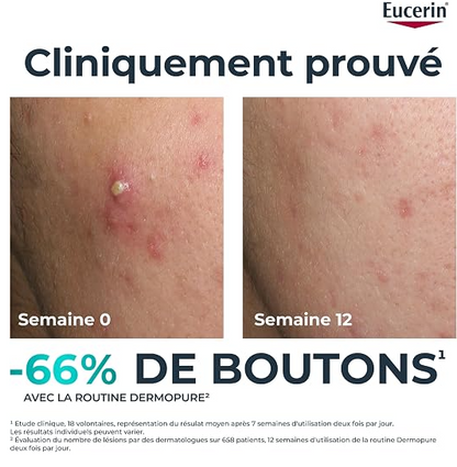 Pack peau grasse, anti-boutons & imperfections- باقة البشرة الدهنية – لمكافحة الحبوب والعيوب