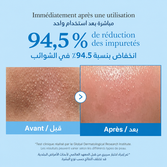 Pack Zero Pores – Double Nettoyage- باقة المسام النقية – تنظيف مزدوج وعناية متكاملة