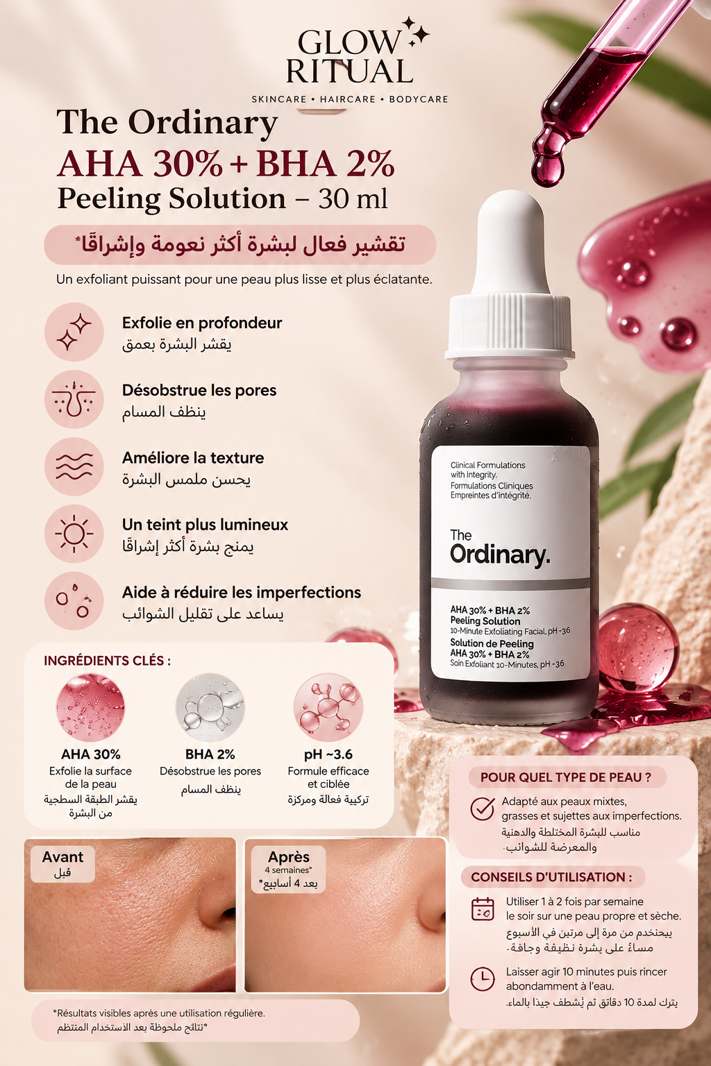 The Ordinary – AHA 30% + BHA 2% Peeling Solution, 30 ml