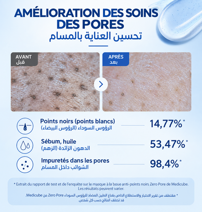 Pack Zero Pores – Pores Purifiés & Peau Nette- باقة المسام النقية – مسام أنقى وبشرة أكثر صفاءً