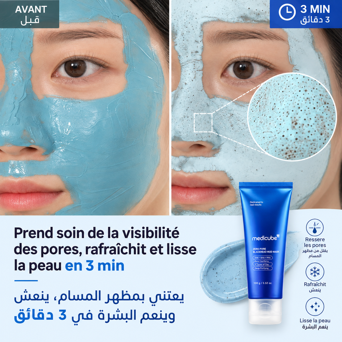 Pack Zero Pores – Pores Purifiés & Peau Nette- باقة المسام النقية – مسام أنقى وبشرة أكثر صفاءً